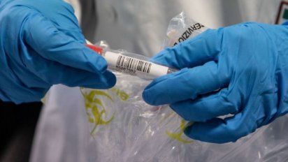 Los casos estarían en buenas condiciones de salud.&nbsp;