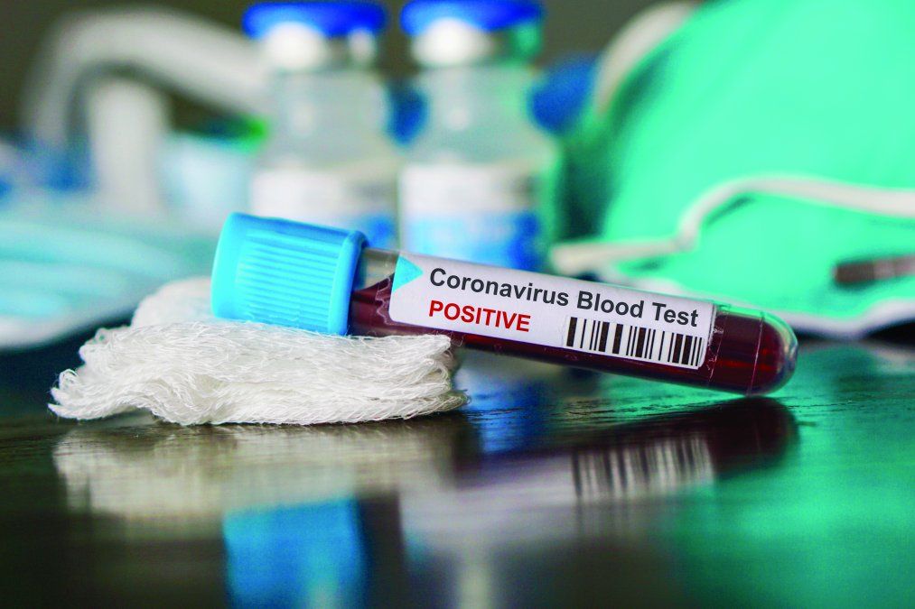 Cerrar fronteras, prohibir los viajes en general y políticas gubernamentales extremas no detendrá la propagación del coronavirus, afirma el WTTC.